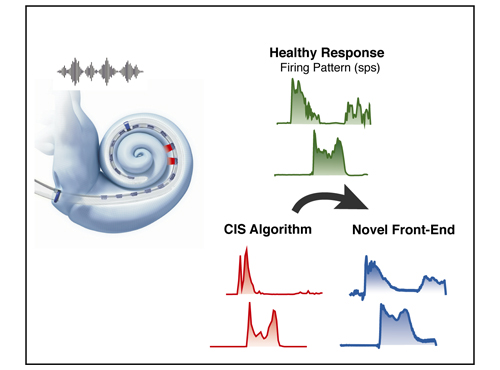 Cochlear Implant Front-End Processing Using Machine Learning