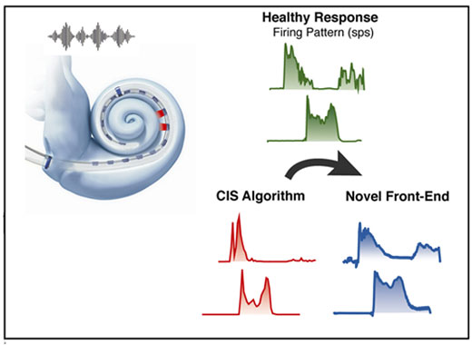 Restoring Pitch Perception in Cochlear Implants